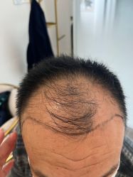 -熙朵美学植发·连锁品牌