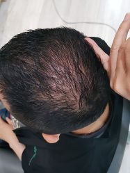 -雍禾植发全国连锁