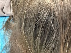 -熙朵美学植发·连锁品牌