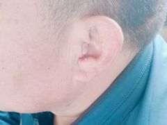 -自然之声助听器·呼吸机(公园路店)