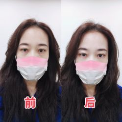 -天津健丽·去眼袋医疗美容机构