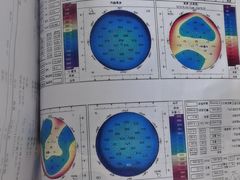 -上海大学附属上海和平眼科医院