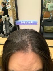 -章光101防脱养发荟