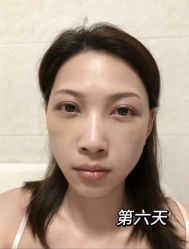 -天津健丽·去眼袋医疗美容机构