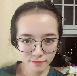 -碧莲盛·不剃发植发