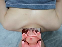-蓝丝带 催乳 产后恢复中心(狮山龙湖店)