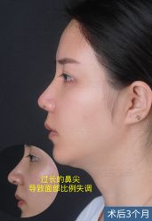-北京米扬丽格医疗美容·联合丽格鼻整形中心