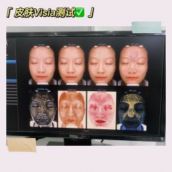 -慕颜医疗美容·皮肤微整 抗衰