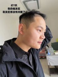 -雍禾植发全国连锁