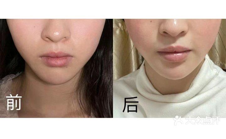 黄金热拉提的害处_黄金热拉提的害处有哪些