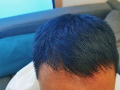 -雍禾植发全国连锁