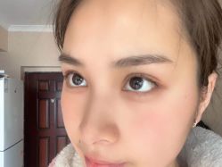-素美医疗美容·西南眼鼻整形·修复基地