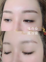 -西施无菌半永久纹绣眉眼影唇轻增发纹发际线