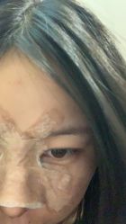 -杭州美莱医疗美容医院
