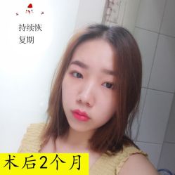 -大麦微针植发全国连锁