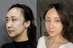 -加减美医美连锁品牌