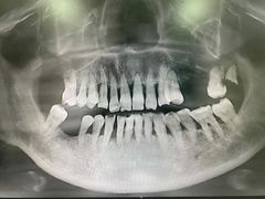-极光口腔·矫正种植修复(锦江店)