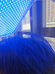 -碧莲盛·不剃发植发