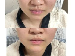 体验后-联合丽格·张菡丽格医疗美容