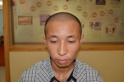 -大麦微针植发丨全国连锁