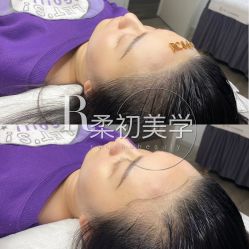 -RC半永久纹眉纹发际线