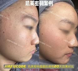 -元熙兰积皮肤管理
