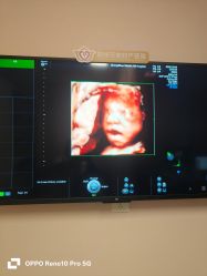 -郑州万安妇产医院