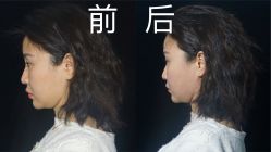 -小忠丽格医美