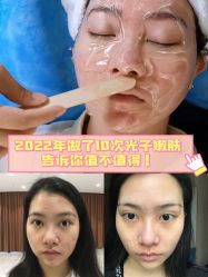 -广州健丽·去眼袋医疗美容机构