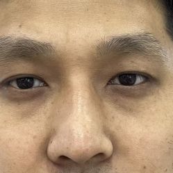 -天津健丽·去眼袋医疗美容机构