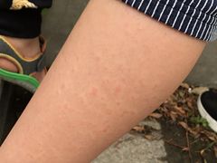 -波塞冬旅游度假区