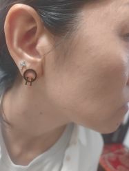 -北京美痣堂古方祛痣斑疣瘊