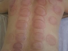 -初心正骨艾灸养生馆