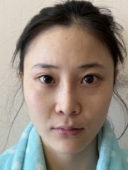 -北京米扬丽格医疗美容·联合丽格鼻整形中心