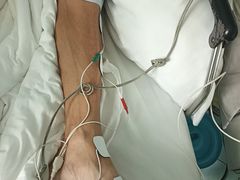 -上海开元骨科医院