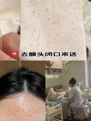 -成都苗方清颜专业祛痘