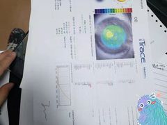 -上海大学附属上海和平眼科医院