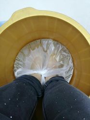 -派恩宜灰指甲鸡眼嵌甲手足癣