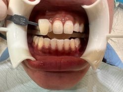 -厦门美莱整形美容医院