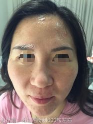 脸部抗衰-光SPA科技美肤