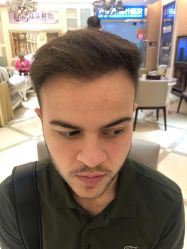 -大麦微针植发丨全国连锁