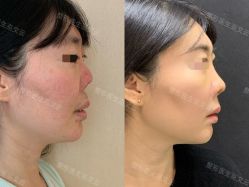 -北京米扬丽格医疗美容·联合丽格鼻整形中心