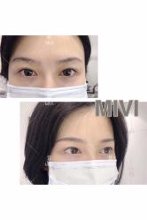 -MIVI半永久纹眉纹绣