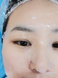 体验后-杭州米兰柏羽医疗美容医院