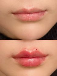 -联合丽格·张菡丽格医疗美容