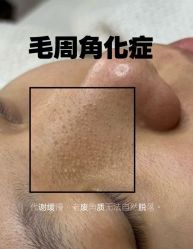 -克丽缇娜