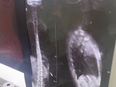 -张钰强中医正骨推拿连锁(华发商都店)