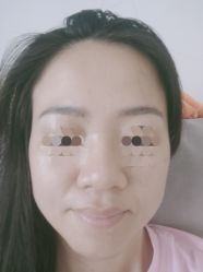 体验后-深圳阳光医疗美容医院·旗舰店