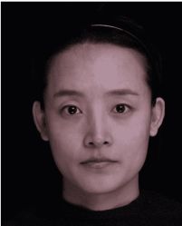 体验前-哈尔滨瑞丽医疗美容医院
