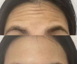 -比华利美容医院